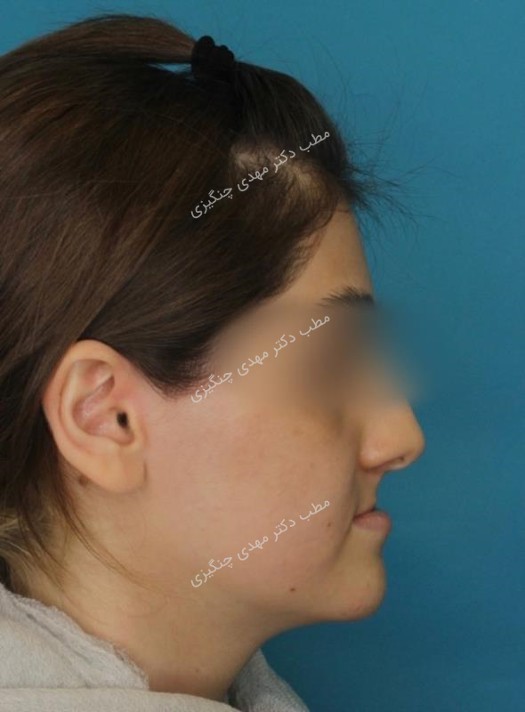 جراحی ارتوگناتیک و جنیوپلاستی در شیراز